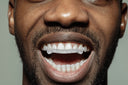 GOLD AND DIAMOND 6 TEETH GRILLZ