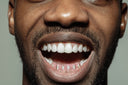 6 TEETH GOLD AND PINK SAPPHIRE GRILLZ