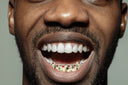8 TEETH GOLD RUBY GRILLZ