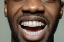 6 TEETH GOLD DIAMOND GRILLZ
