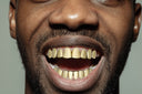 8 TEETH PERM STYLE GOLD GRILLZ