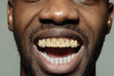 GOLD 8 TEETH DIAMOND CUT GRILLS