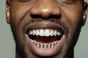 GOLD 8 TEETH TEETH RUBY GRILLZ