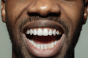 GOLD AND DIAMOND ONE TOOTH CAP GRILL