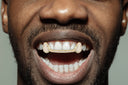 GOLD 6 TEETH FULL DIAMOND BAR GRILLS
