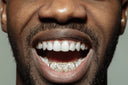 GOLD 6 TEETH DIAMOND DUST/DIAMOND CUT GRILLS