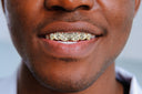 GOLD 6 TEETH DIAMOND DUST GRILLS
