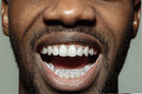 GOLD 8 TEETH DIAMOND DRIP GRILLS