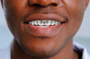 GOLD 8 TEETH DIAMOND CUT GRILLS