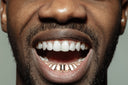 GOLD 10 TEETH GOLD GRILLS