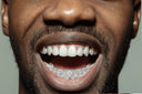 GOLD 8 TEETH FULL DIAMOND GRILLS