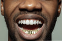 GOLD 8 TOOTH GOLD GRILLS