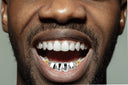 GOLD 6 TOOTH 3D DESIGN FLOWER GRILLS