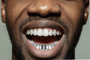 GOLD 8 TEETH PLAIN GRILLS